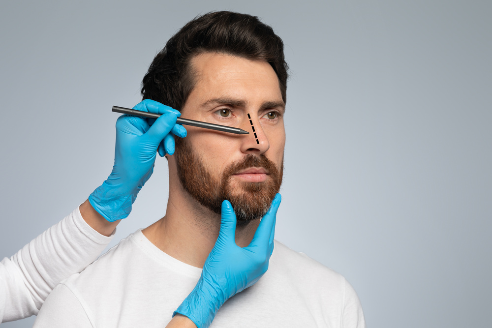 Rhinoplasty For Men